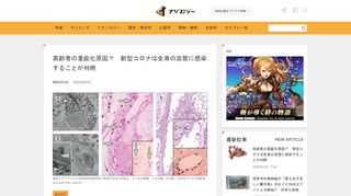 point 新型コロナウイルスに対して高齢者や持病がある人が脆弱である医学的理由が判明した 新型コロナウイルスは全身の血管に感染するため、血管が弱っ...